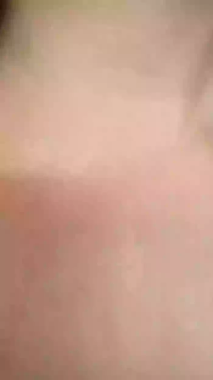 Melacam
