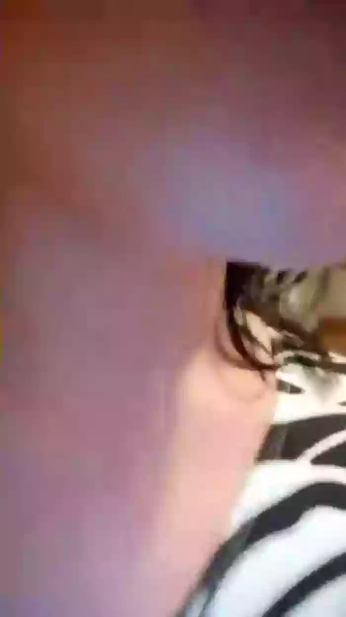 Melacam